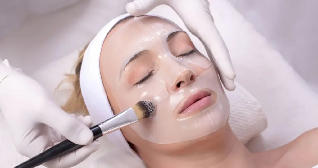 chemical peel treatment