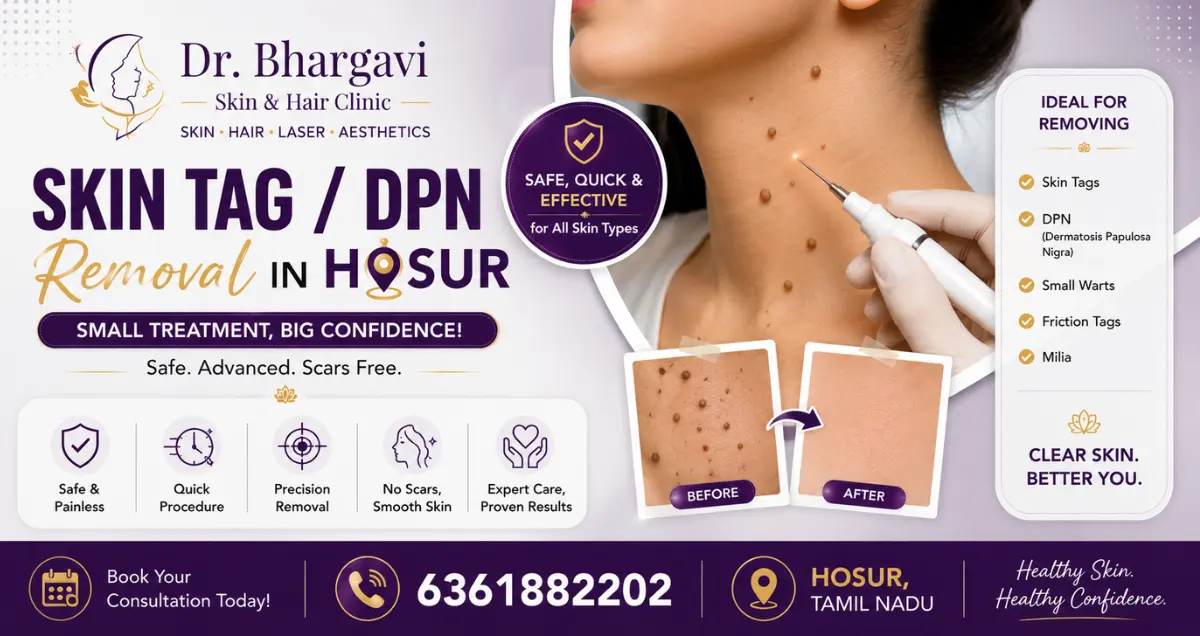 Skin Tag _ DPN Removal in Hosur